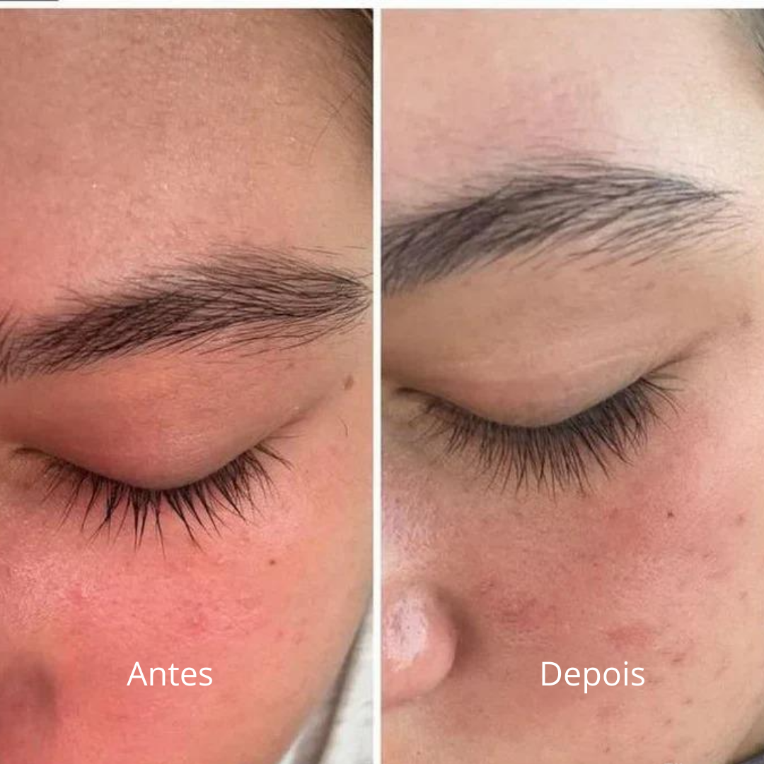Cosmic Lash - Sérum Para Crescimento de Pestana