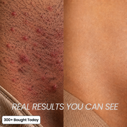 Anti-Hair Growth Oil