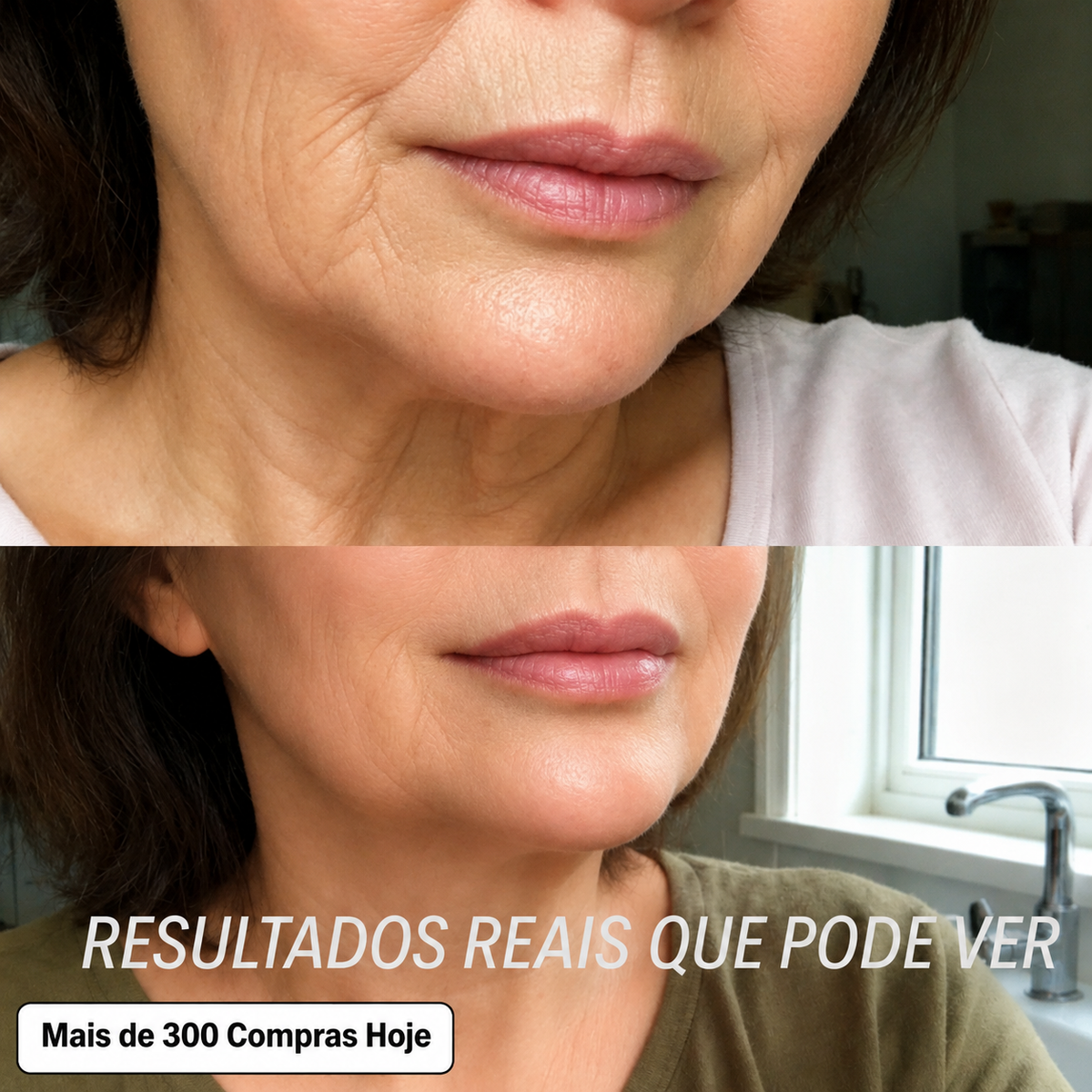 Transforme Rugas, Linhas Finas e Vincos de Expressão Cansados de Forma Natural