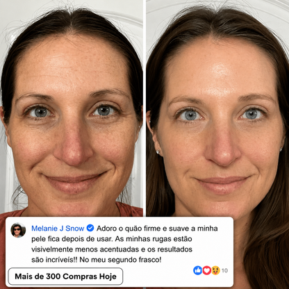 Transforme Rugas, Linhas Finas e Vincos de Expressão Cansados de Forma Natural