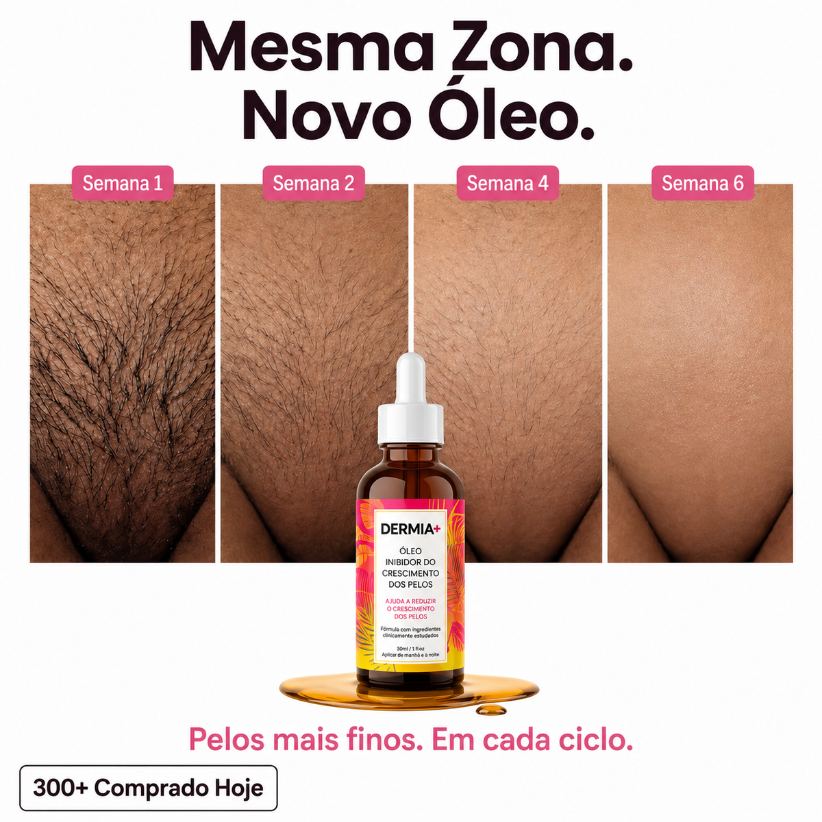 Óleo Inibidor do Crescimento dos Pelos