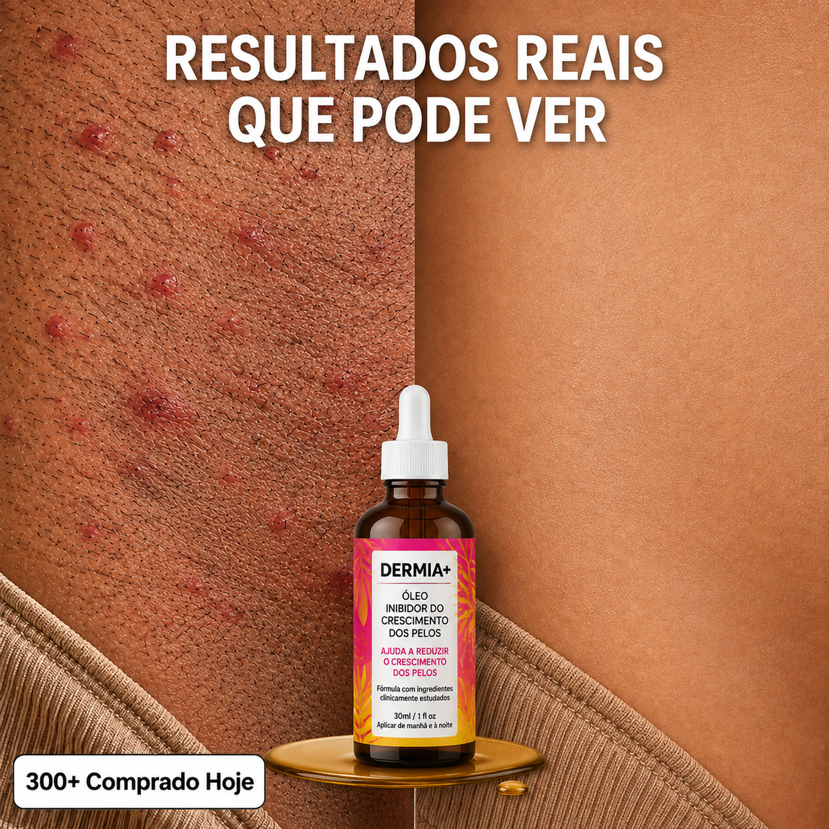 Óleo Inibidor do Crescimento dos Pelos
