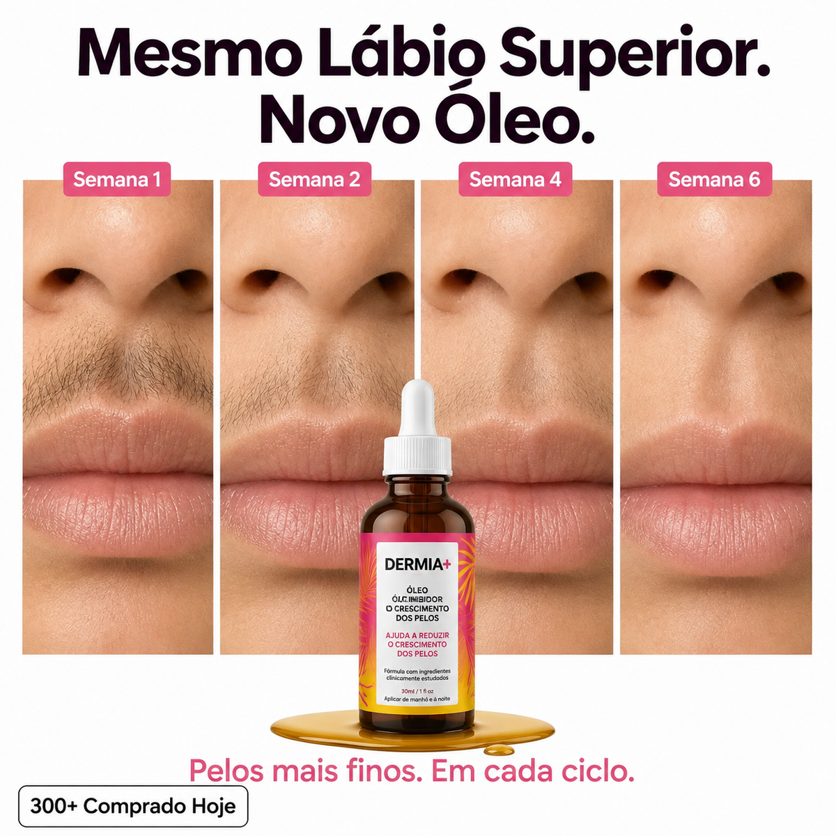 Óleo Inibidor do Crescimento dos Pelos