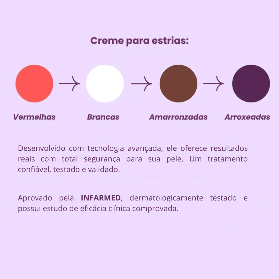 Daily Tratamento - Creme Para Estrias