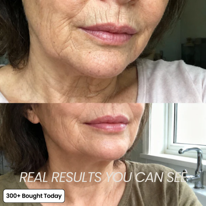 Collagen Plump & Repair Balm