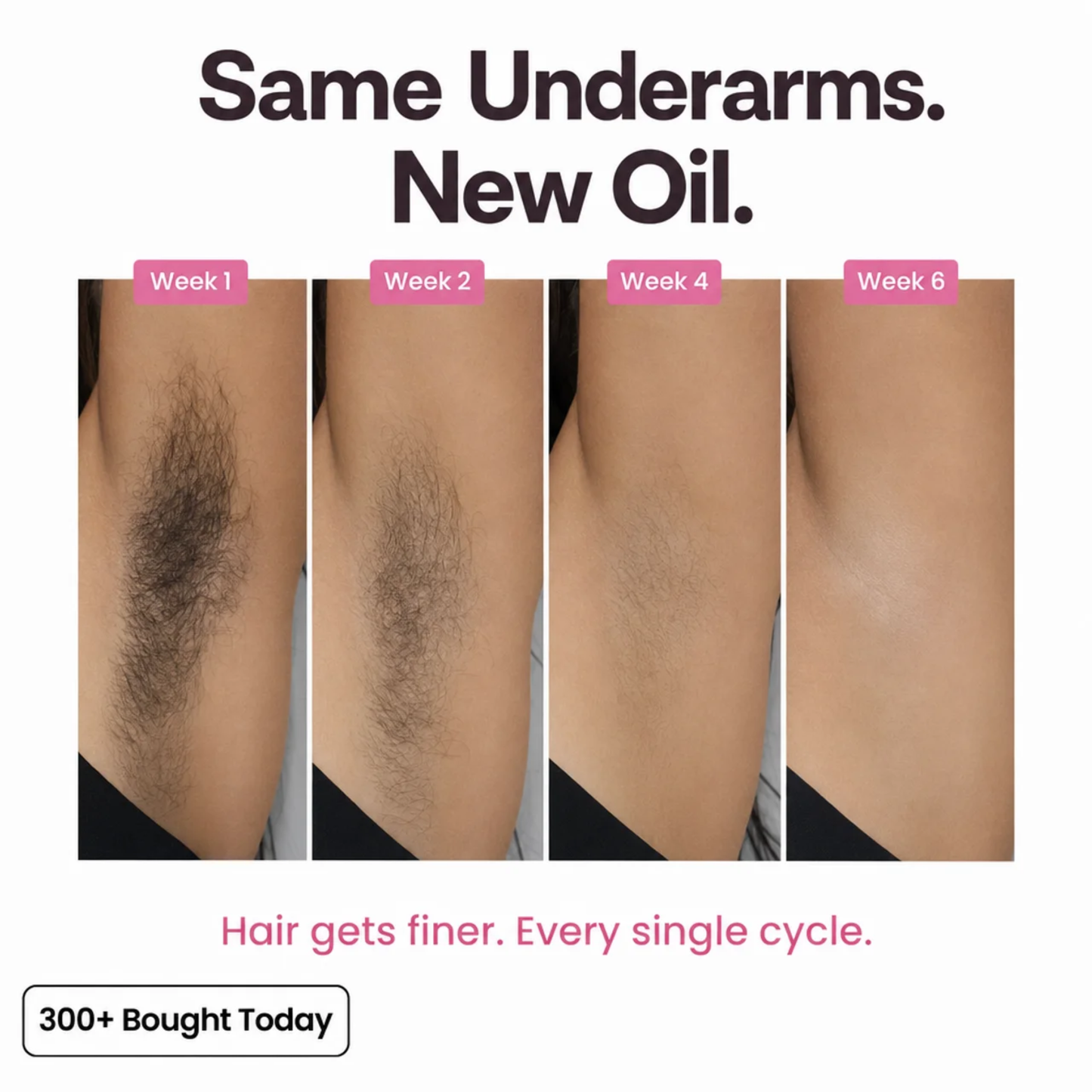 Anti-Hair Growth Oil